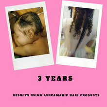 Load image into Gallery viewer, Superior hair growth oil