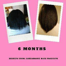 Load image into Gallery viewer, Superior hair growth oil
